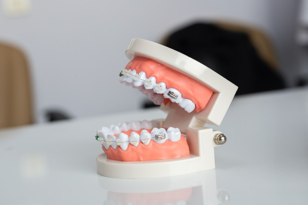 Ankara Ortodonti Uzmanı - İnvisalign Plaklarının Temizliği