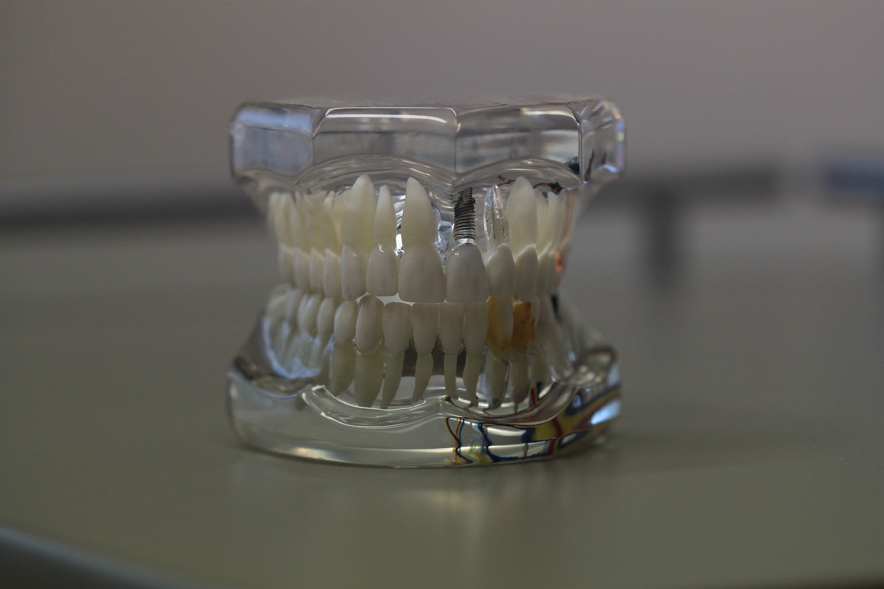 Ankara Şeffaf Plak - Invisalign Plaklarının Yemekle İlgili En İyi Pratikler: İpuçları ve Püf Noktaları