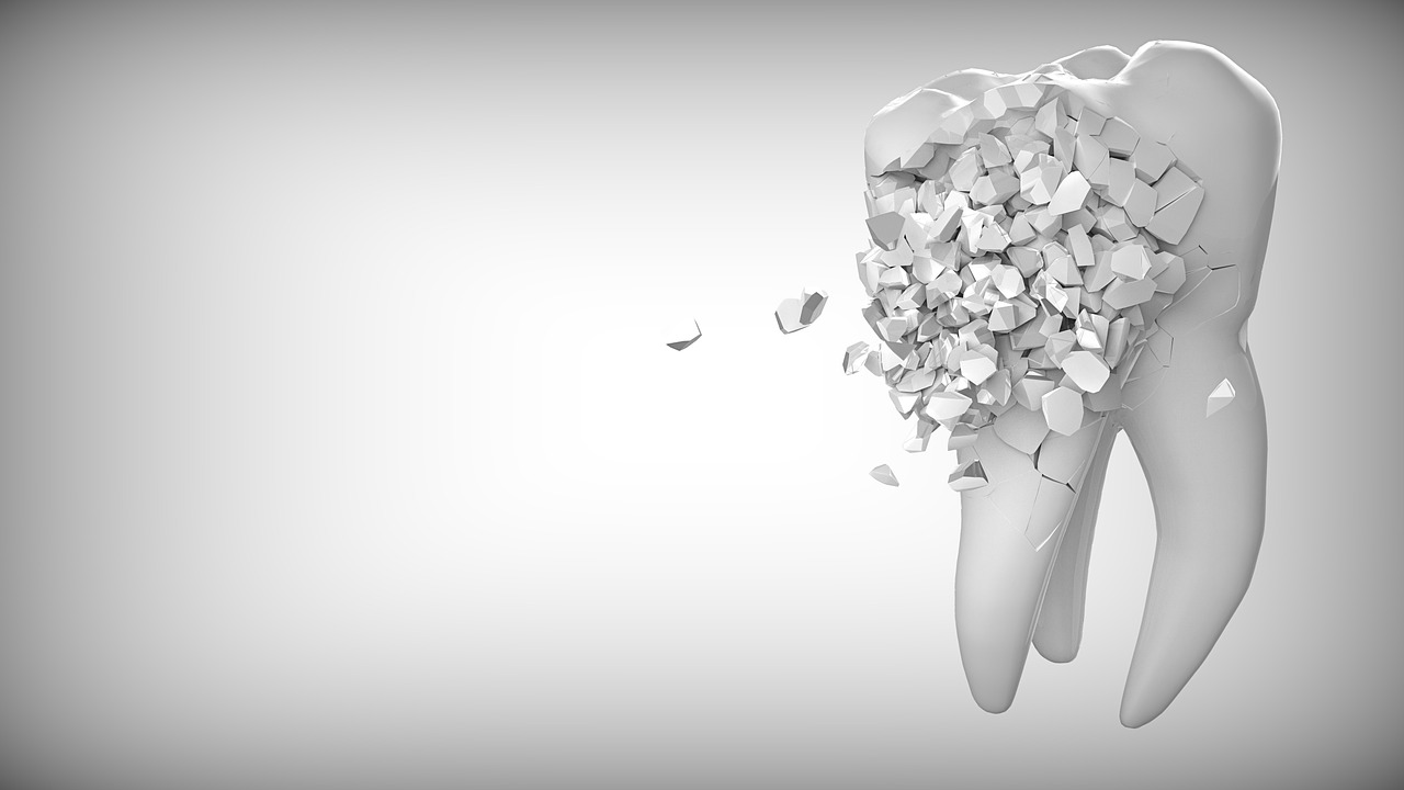 Ankara İnvisalign Klinik - İnvisalign Tedavi Planlaması ve Kişiselleştirilmiş Tedavi Aşamaları
