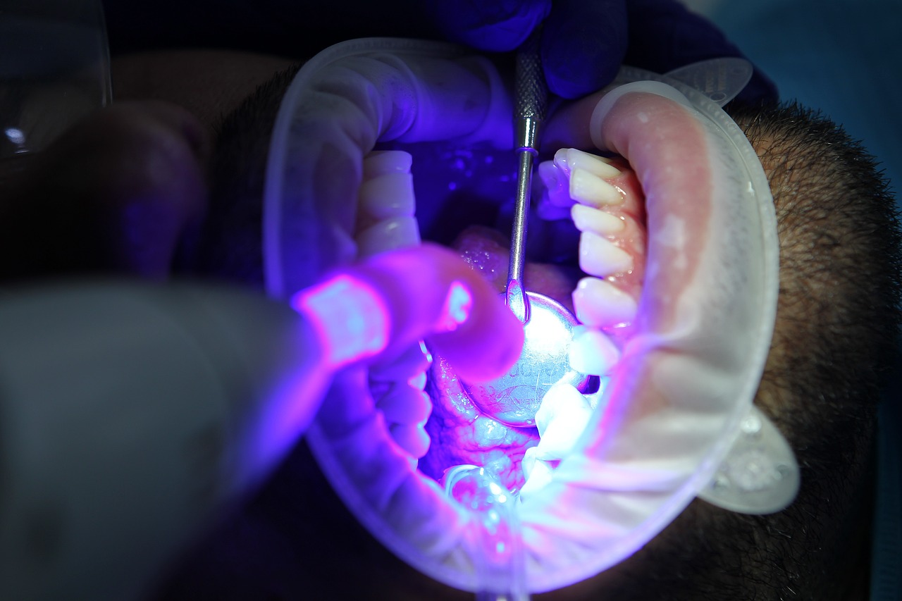 Ankara İnvisalign Doktor - Diğer Ağız Bakım Araçlarını Invisalign Plaklarınızla Nasıl Senkronize Hale Getirebilirsiniz?