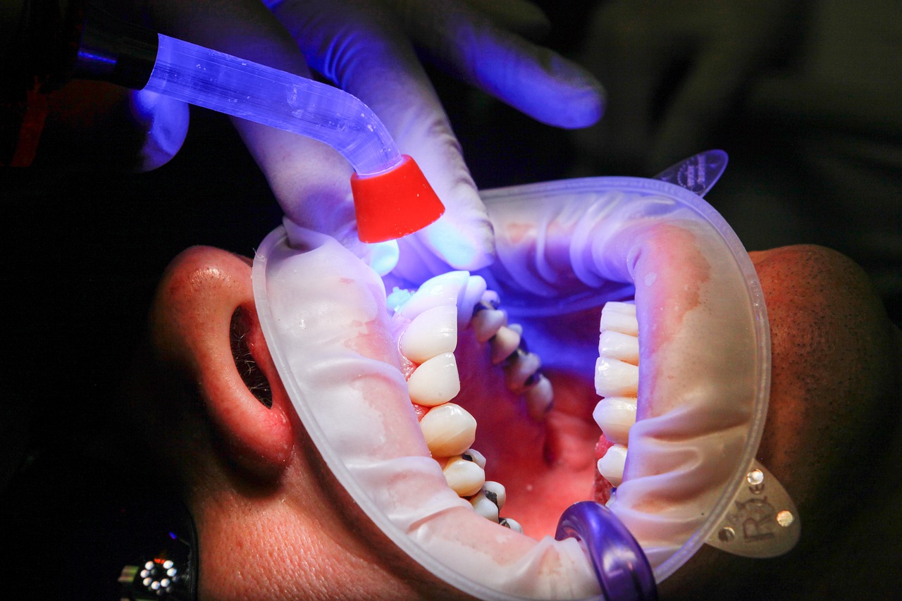 Ankara İnvisalign - Invisalign Plaklarının Hijyenik Saklanması