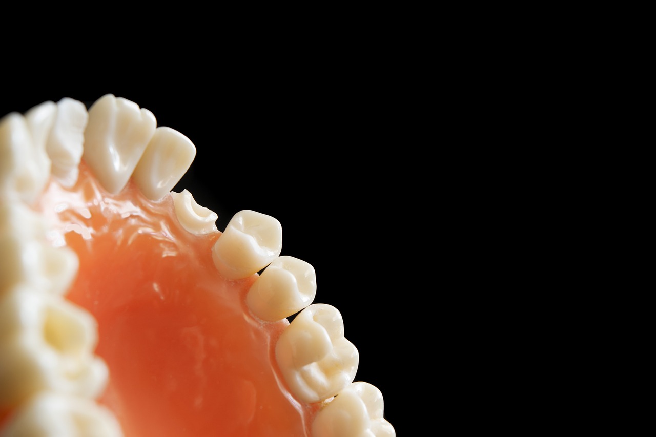 Ankara İnvisalign Tedavi - İnvisalign Şeffaf Plaklarla Diş Düzeltme