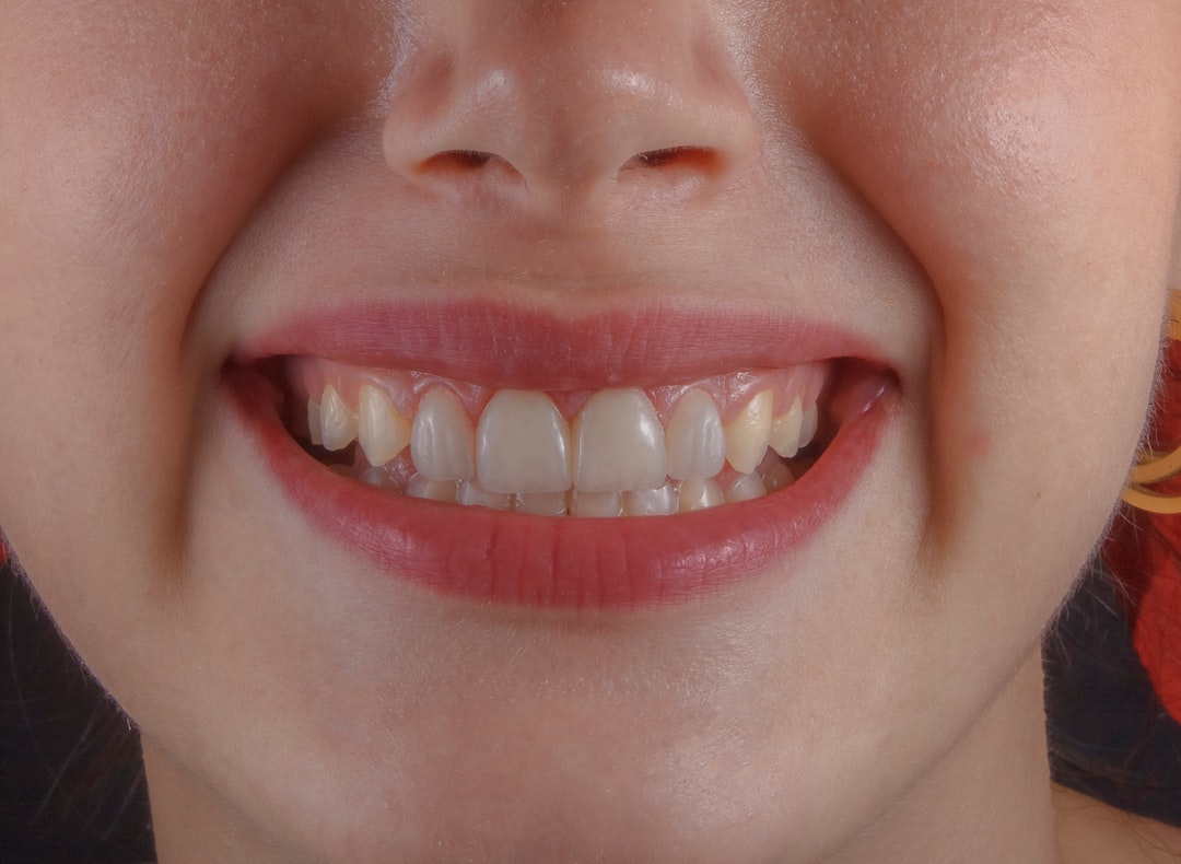 Ankara İnvisalign Doktor - Invisalign ve Sabit Retainer: Hangisi Daha İyi Gece Kullanımı İçin Uygun?