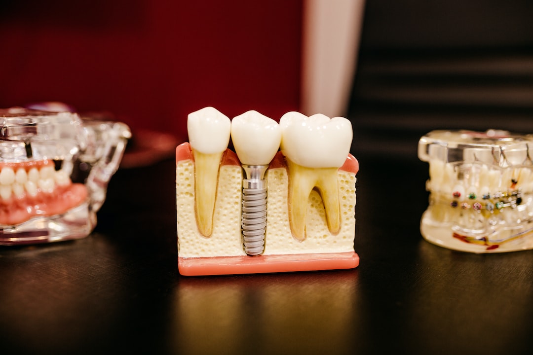 Ankara İnvisalign Doktor - Invisalign ve Sabit Retainer: Hangisi Daha İyi Gece Kullanımı İçin Uygun?