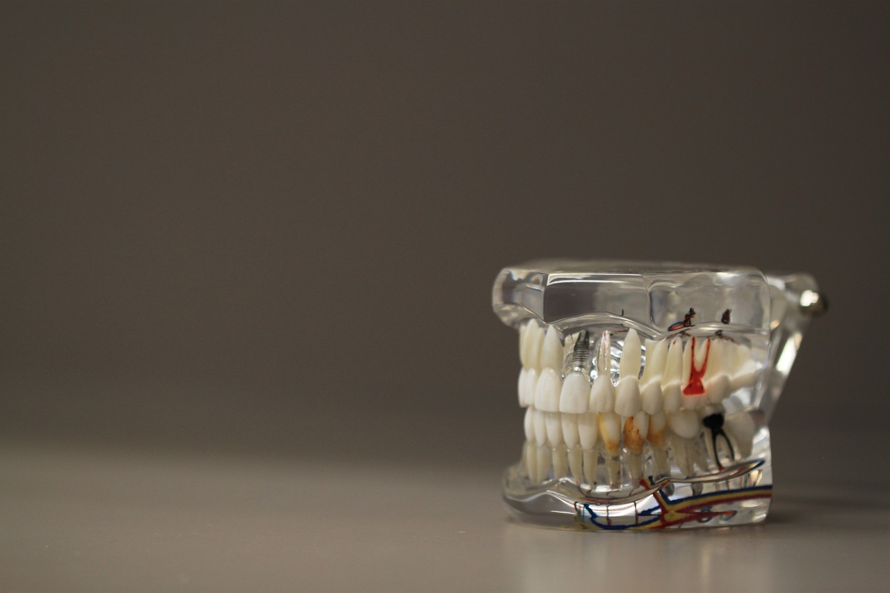 Ankara Şeffaf Plak - Invisalign Tedavisinin Psikolojik Avantajları