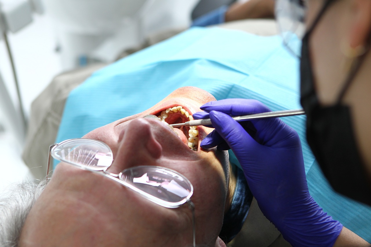 Ankara İnvisalign Doktor - İnvisalign Plaklarını Nasıl Kullanmalısınız: Temel İpuçları