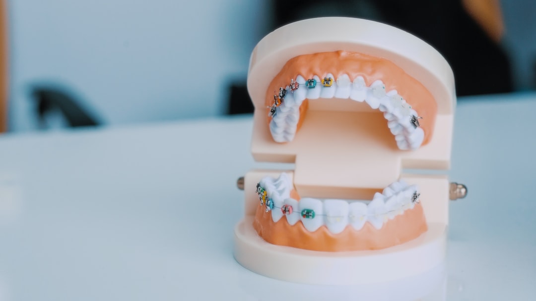 Ankara İnvisalign - Invisalign Nedir?
